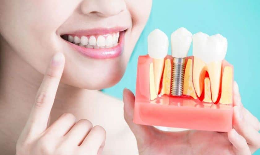 Dental Implants in Tempe