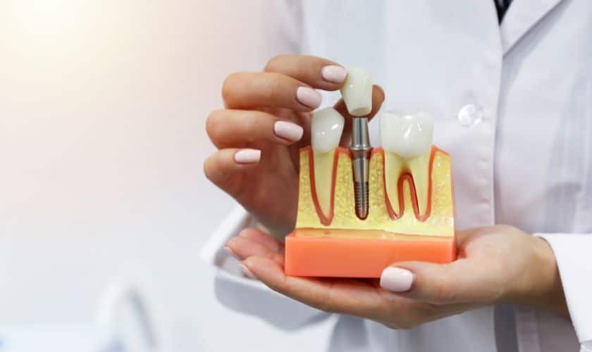 Dentist holding dental implant model showing tooth replacement components and gum structure.