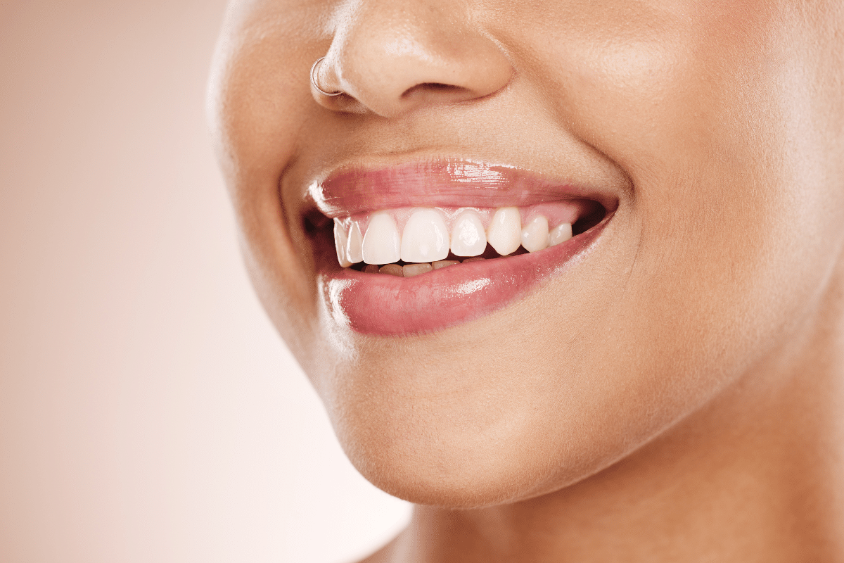 Whitening Aftercare Tips