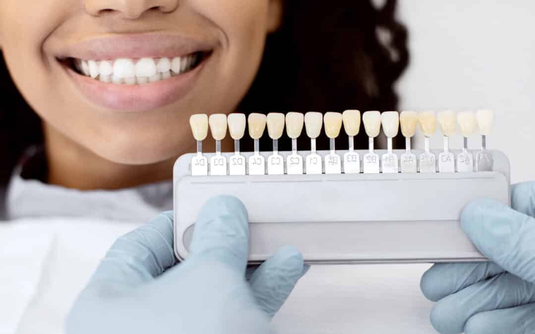 Porcelain Veneers Cost & Longevity in Tempe, AZ