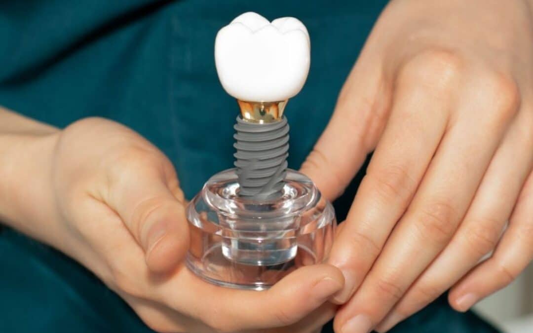What to Eat After Dental Implant Surgery: A Day by Day Guide