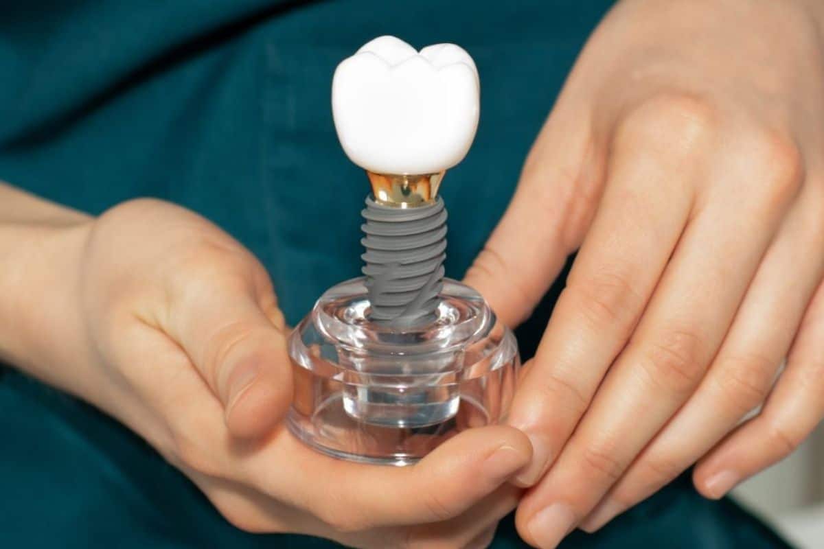 Dental Implants Food guide